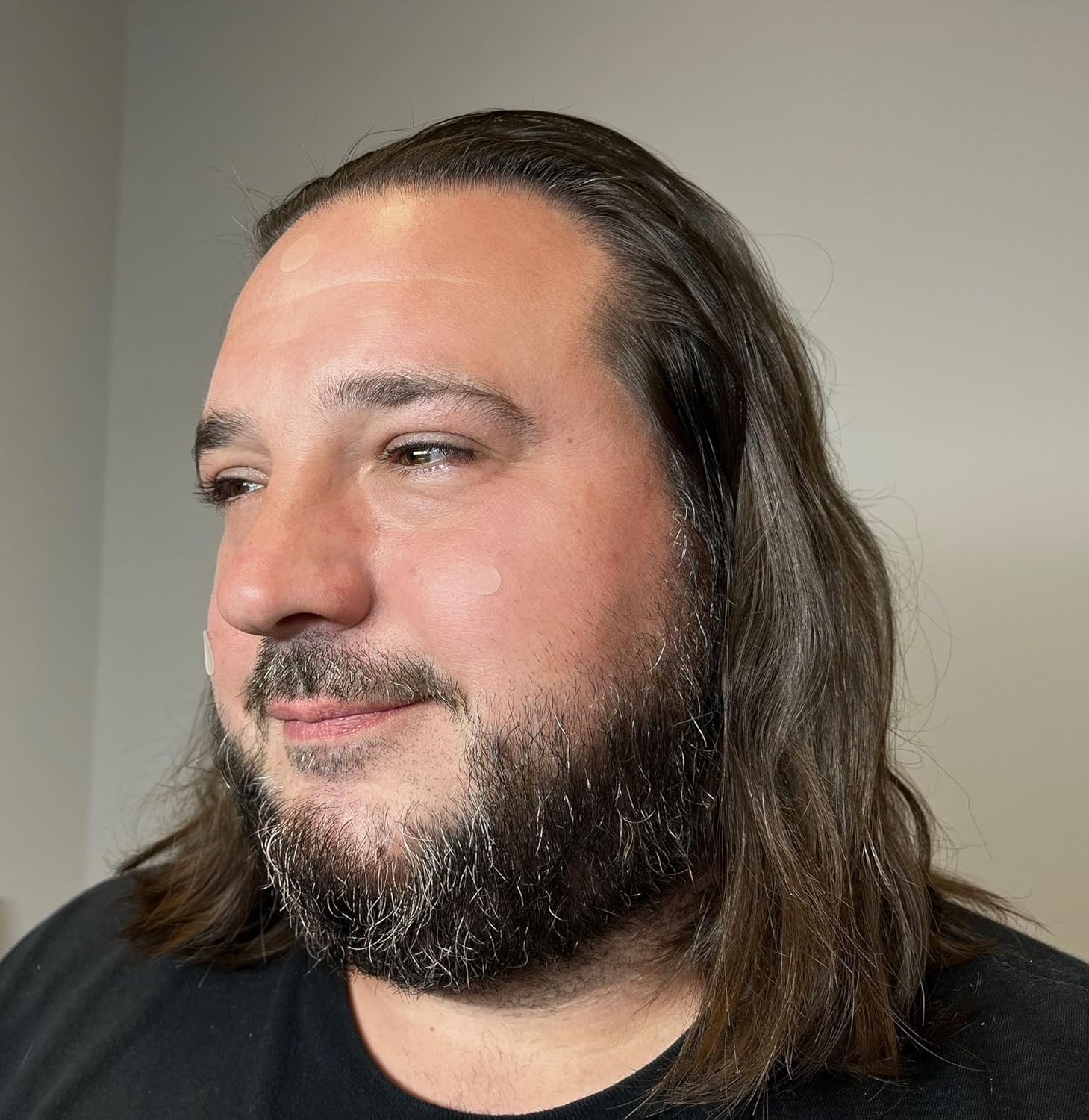 Pimple Patch with Tea Tree Oil by PatchAid (105 Count) - Image 6